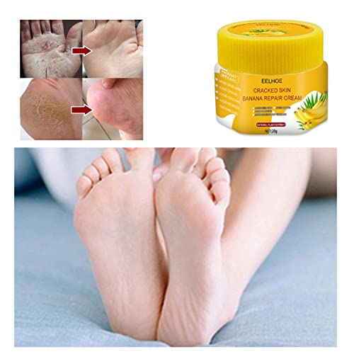 ZITIANY Cracked Skin Banana Repair Cream - Natural Foot & Hand Moisturizer for Dry Skin, Exfoliating & Soothing Treatment - Softens Rough Elbows, Heels & Cracked Feet - Ideal for Night Care & Pedicures
