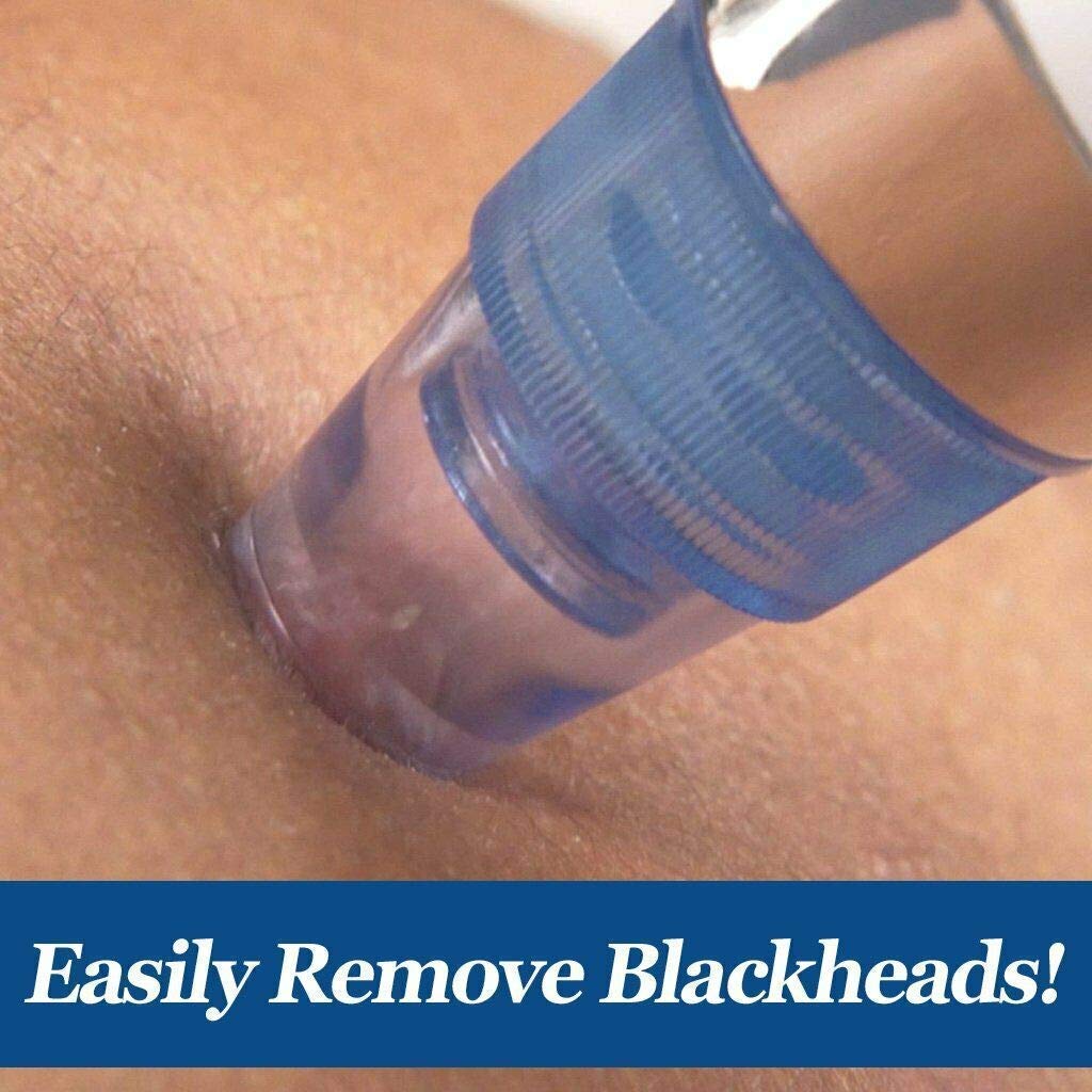 UCRAVO Blackhead Remover Vacuum Machine - Pore Cleaner & Pimple Extractor Tool for Women & Men | Facial Skin Care Device for Blackhead Removal & Deep Cleansing | Perfect for Daily Skincare Routine & Spa Treatments