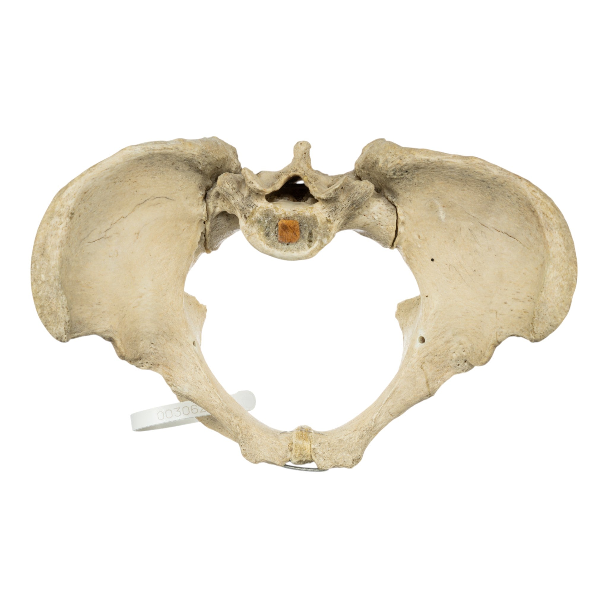 Real Human Pelvis and Sacrum Articulated - Anatomical Model for Medical Education, Study, and Display