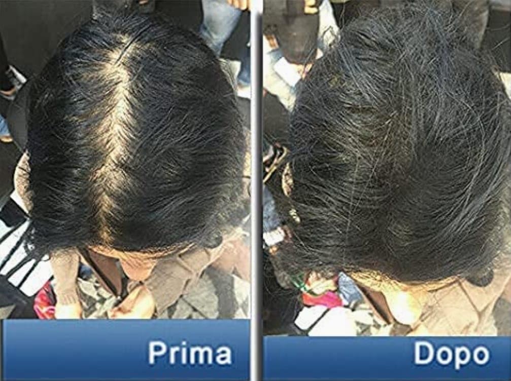 Pantogar (Pantovigar) Hair and Nails Growth Supplement - 90 Capsules for Stronger Hair & Healthier Nails - Perfect for Thinning Hair and Brittle Nails Care