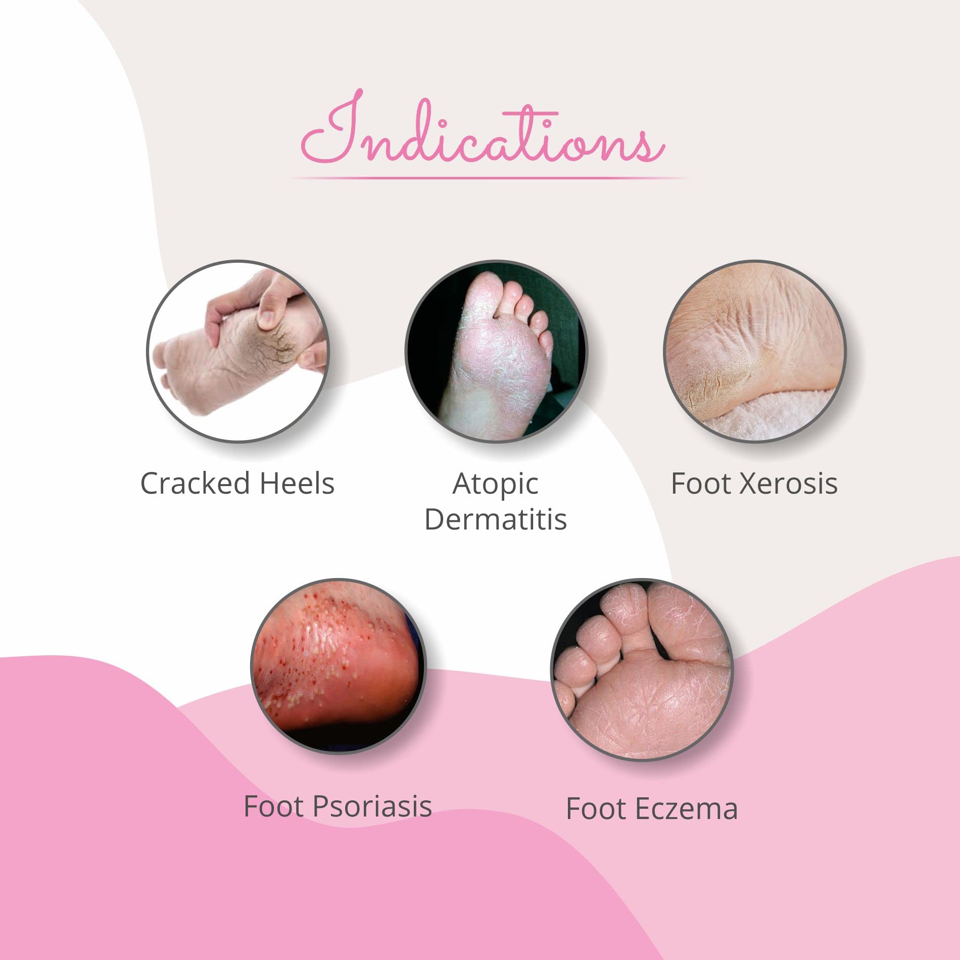 Footvital Moisturizing Foot Cream with Kokum Butter - Heals Dry, Cracked Heels & Softens Hard Corns | Non-Greasy Winter Foot Care for Smooth Skin | Perfect for Daily Use & Overnight Foot Repair - 50gm