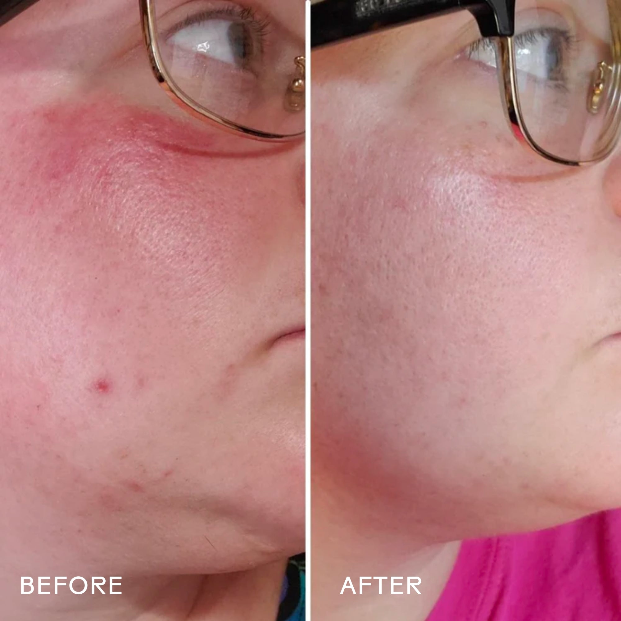 Radiance Grape Stem Cell & Squalane Ultra Hydrating Face Cream - Anti-Aging Moisturizer for Dry Skin | Day & Night Use for Glowing Complexion