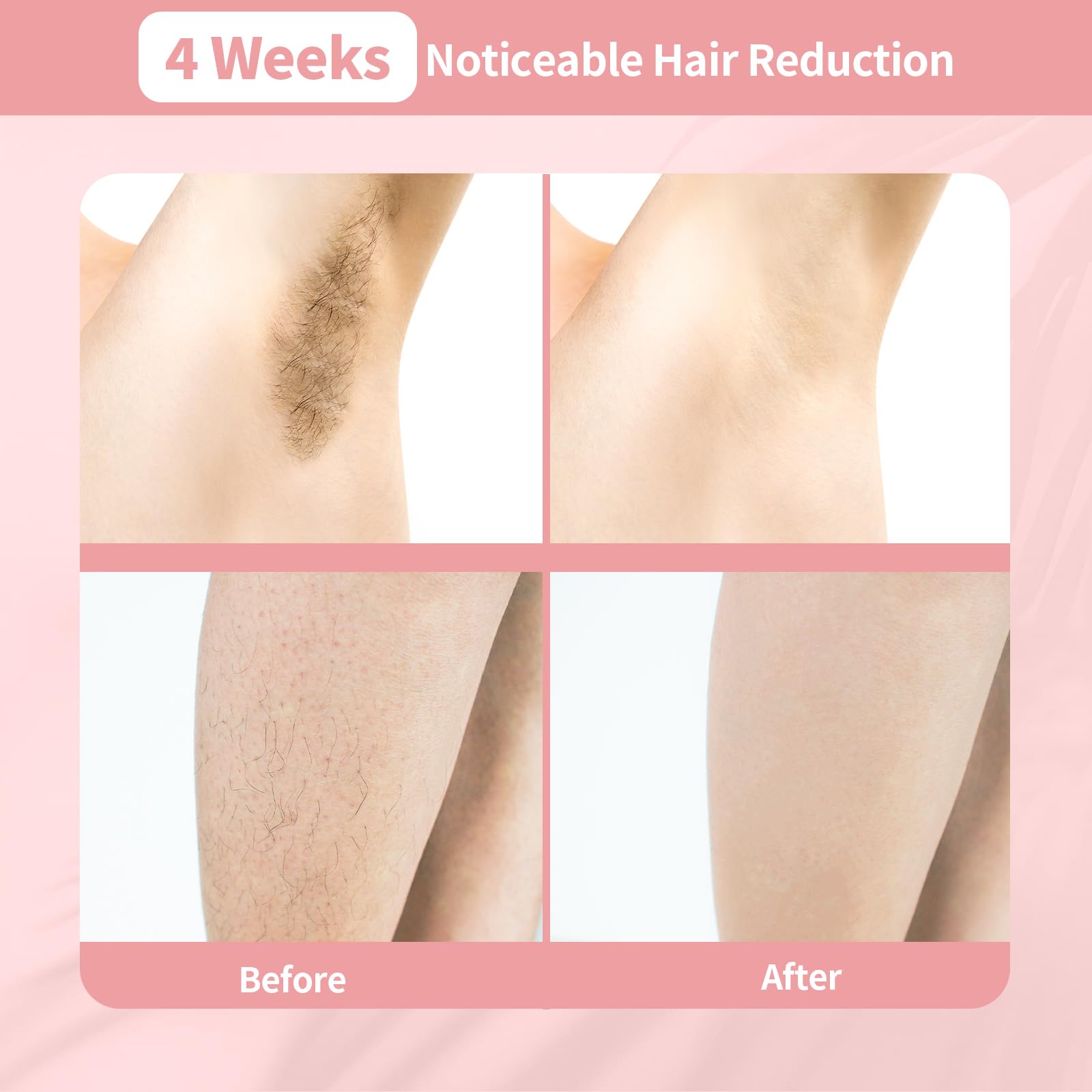 Professional IPL Laser Hair Removal Machine with Ice Cooling - 3-in-1 Painless Home Hair Removal Device for Face, Legs & Body - Safe & Effective for Women & Men - Perfect for Smooth Skin at Home, Salon or Travel