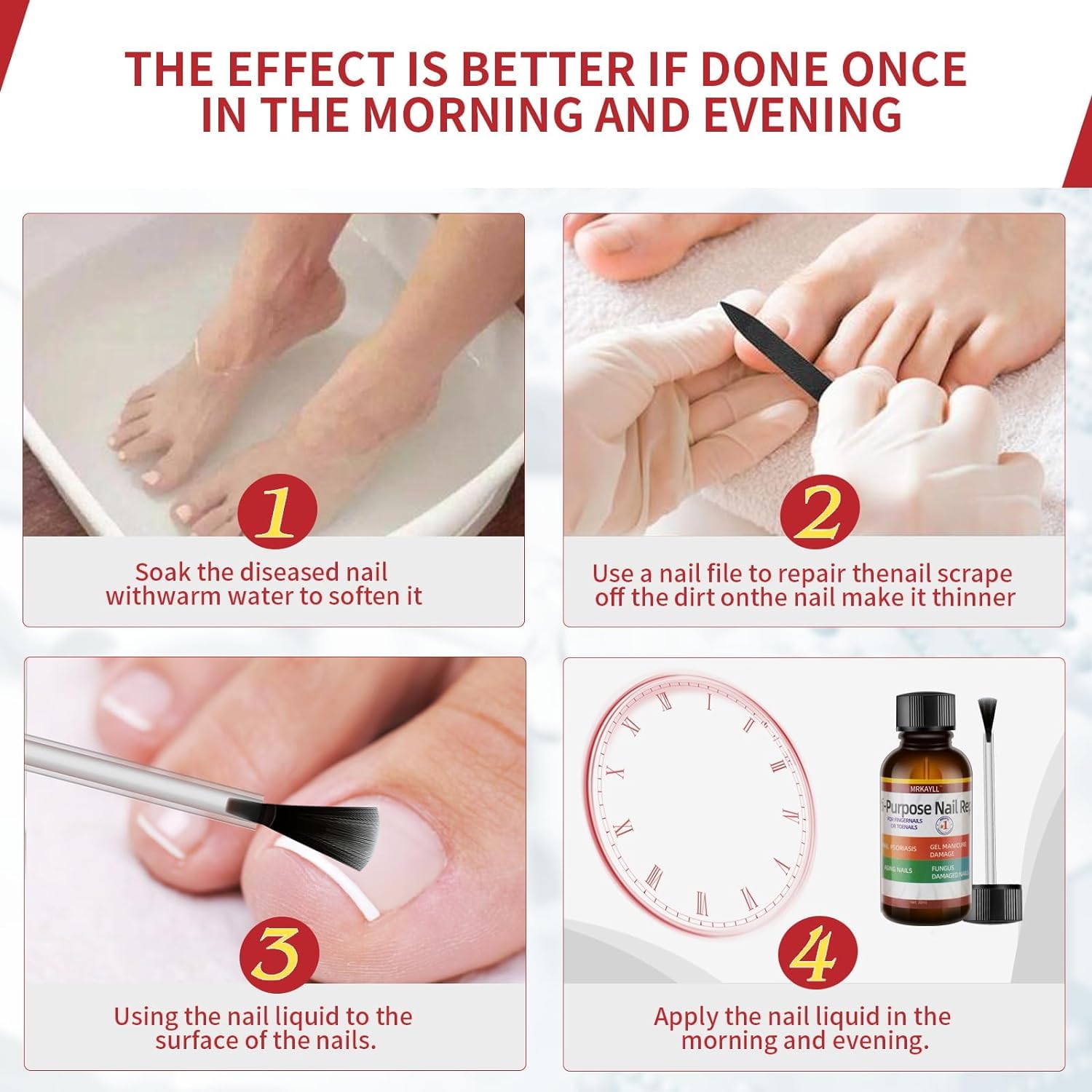 Extra Strength Toenail Fungus Treatment - Fast Acting Antifungal Solution for Toenails & Fingernails | 30ML (1 FLOZ) | Effective Remedy for Athlete's Foot & Nail Discoloration