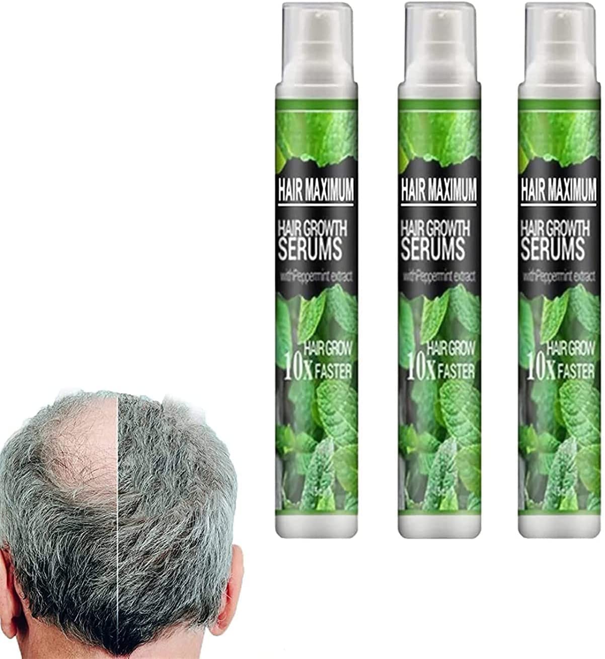 Natural Herbal Hair Growth Essence Spray - Prevent Postpartum Hair Loss & Stimulate Fast Growth | Anti-Hair Loss Serum for Dry Hair (3 Pack) | Perfect for Post-Pregnancy Care & Daily Hair Regimen