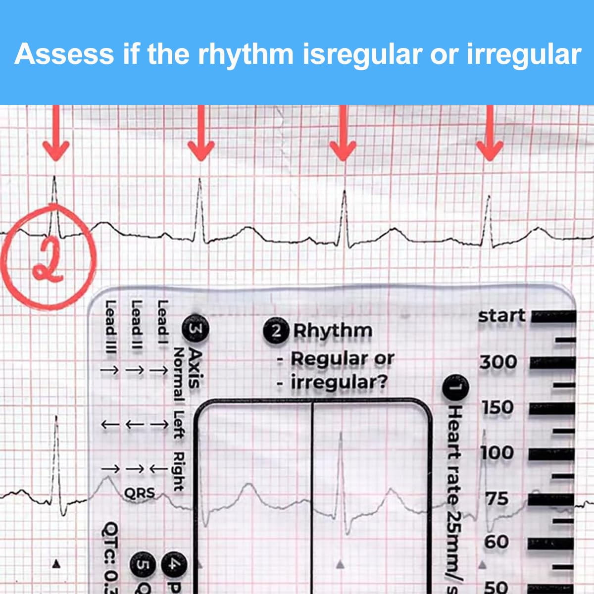 7-Step ECG Ruler for EKG Interpretation - Transparent Caliper Measuring Tool with Portable Assessment Card (2PCS) - Perfect for Medical Students, Nurses & Doctors for Heart Rate Monitoring & ECG Analysis