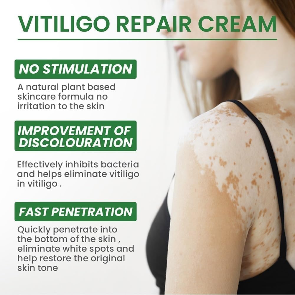 Vitiligo Treatment Cream - White Spot Remover & Skin Pigmentation Corrector | Soothing Moisturizer for Vitiligo Care | Reduces White Patches & Improves Skin Tone (2 Pack) - Ideal for Daily Skincare Routine & Spot Treatment