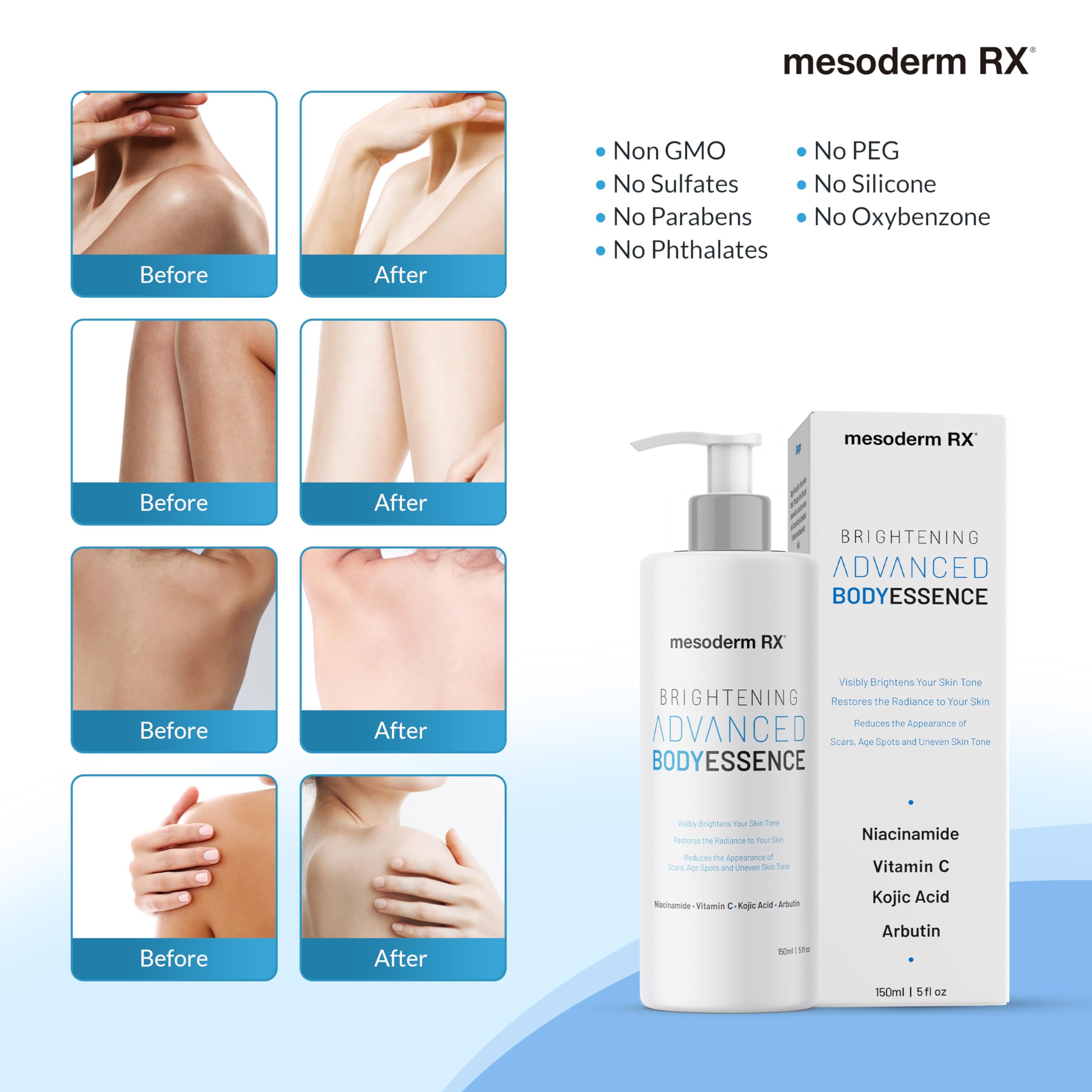 Niacinamide & Vitamin C Body Essence for Hydration & Brightening - Kojic Acid, Hyaluronic Acid & AHA to Smooth Skin, Reduce Dark Spots & Even Tone - 150ml - Perfect for Daily Skincare Routine & Post-Sun Care