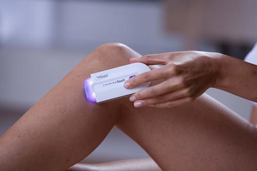 Yes!™ Hair Remover - Painless Facial & Body Hair Removal for Women & Men | Smooth Skin at Home | Perfect for Bikini Line, Underarms & Legs