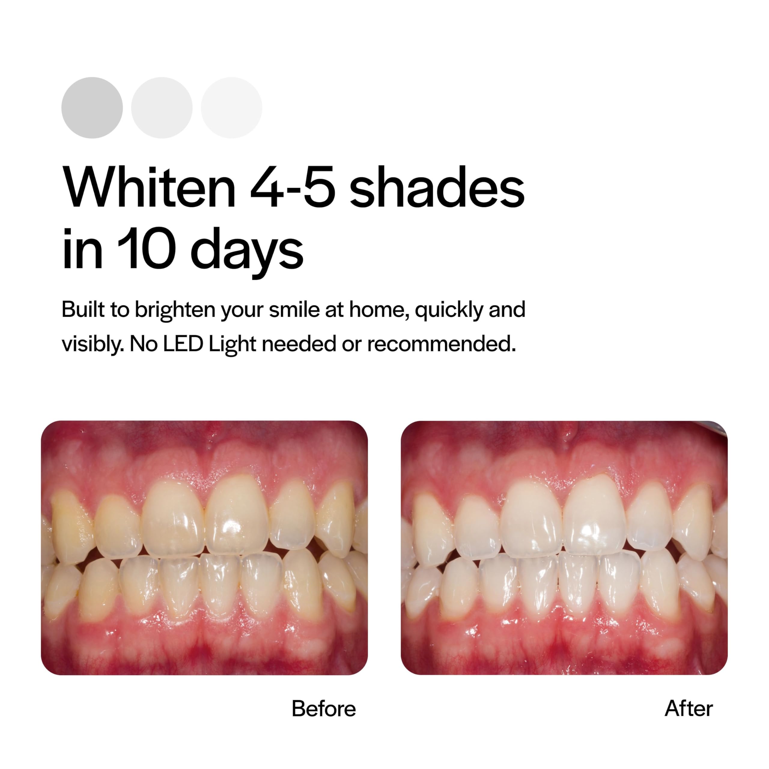 Opalescence Go Teeth Whitening Trays - 15% Hydrogen Peroxide Prefilled Trays (4 Treatments, 2 Packs) - Cool Mint Flavor - Professional Whitening for Sensitive Teeth - Perfect for Travel & Home Use - Made by Ultradent 4648-2