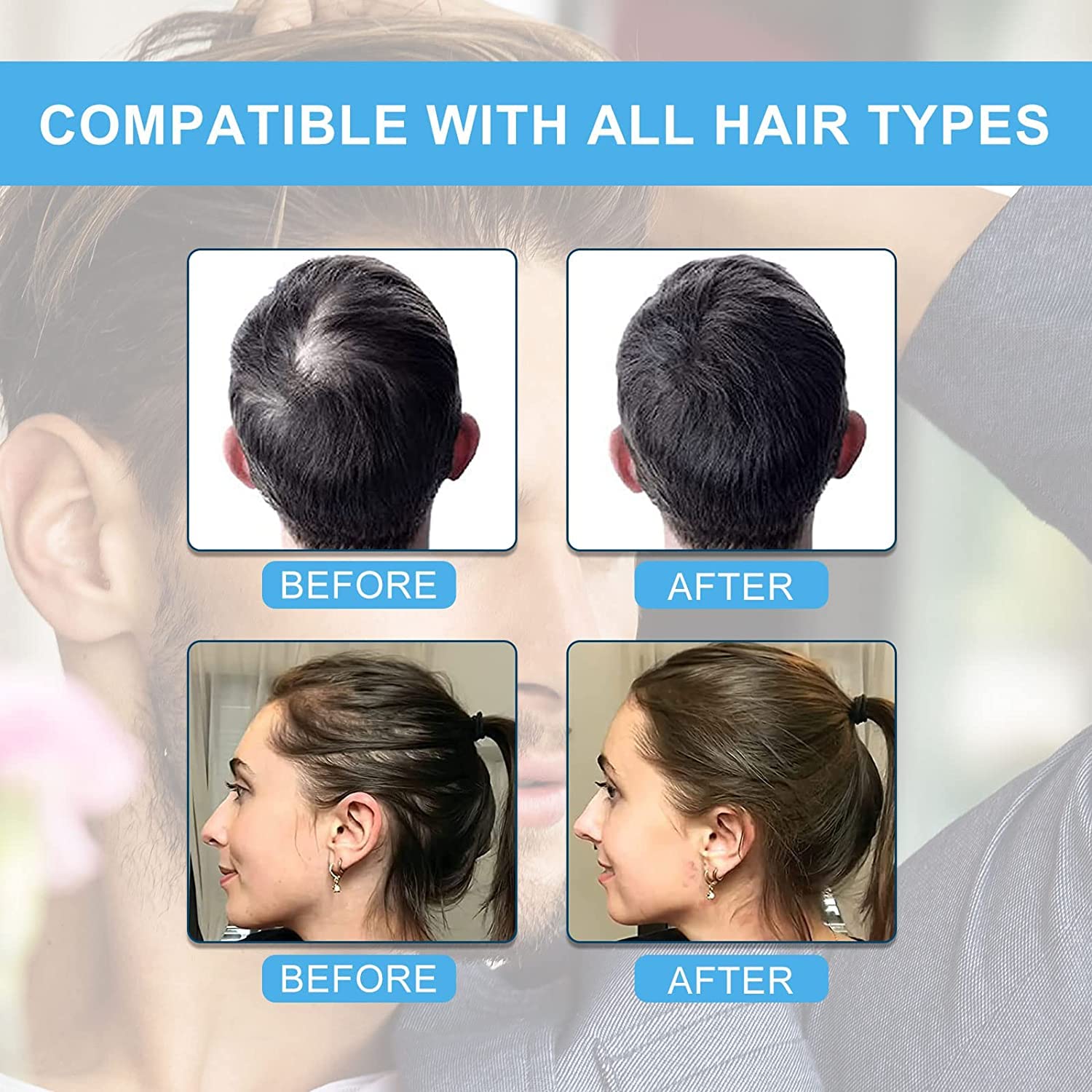 Stylazo Hair Building Fibers for Thicker Looking Hair - 25g Refill Pack (Black) | Instant Hair Volume Solution for Men & Women | Perfect for Daily Use, Special Occasions & Hair Loss Concealment
