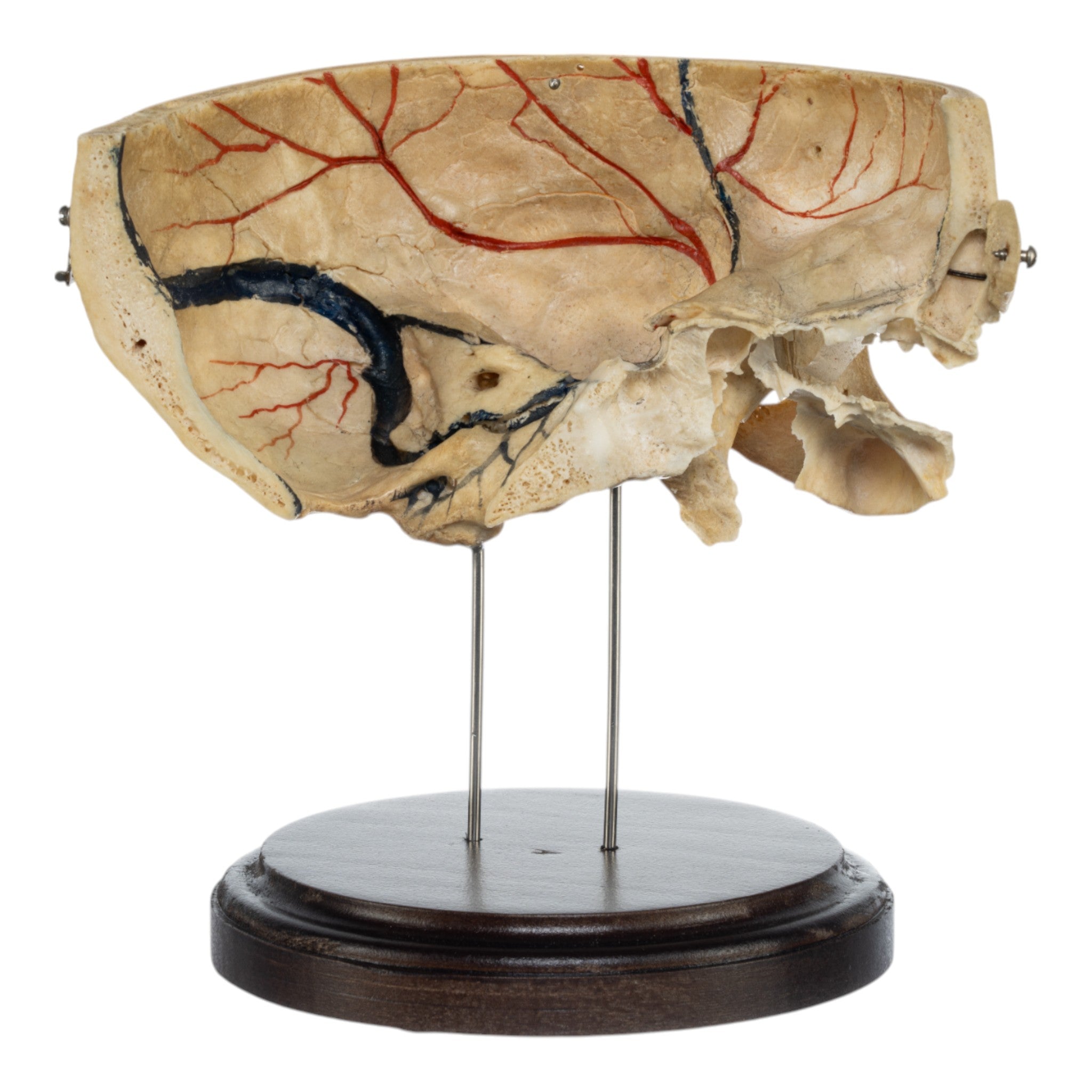 Real Human Partial Skull Replica with Display Stand - Perfect for Anatomy Study, Medical Education & Halloween Decor