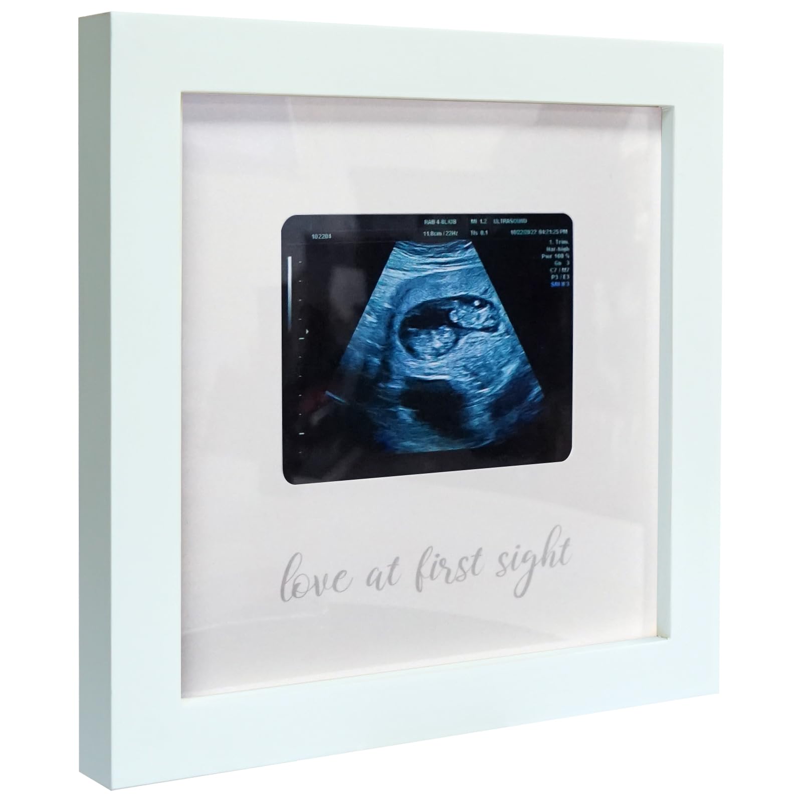Ultrasound Picture Frame - Pregnancy Announcement Gift for Grandparents | Nursery Décor