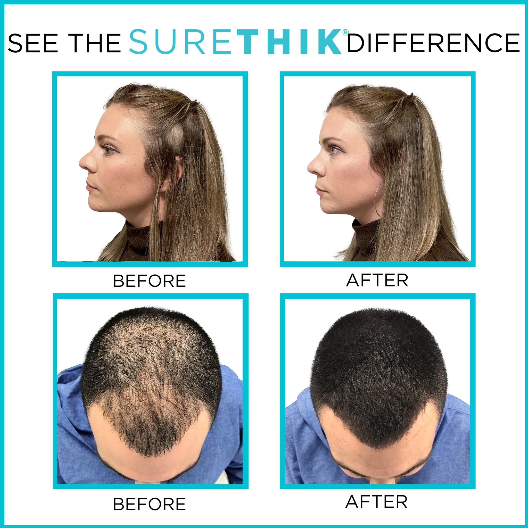 SURETHIK Hair Thickening Fibers - 4 Pack (30g Each) Medium Brown - Instant Hair Volume Solution for Thinning Hair - Men & Women - Perfect for Daily Use, Special Occasions & Confidence Boosting