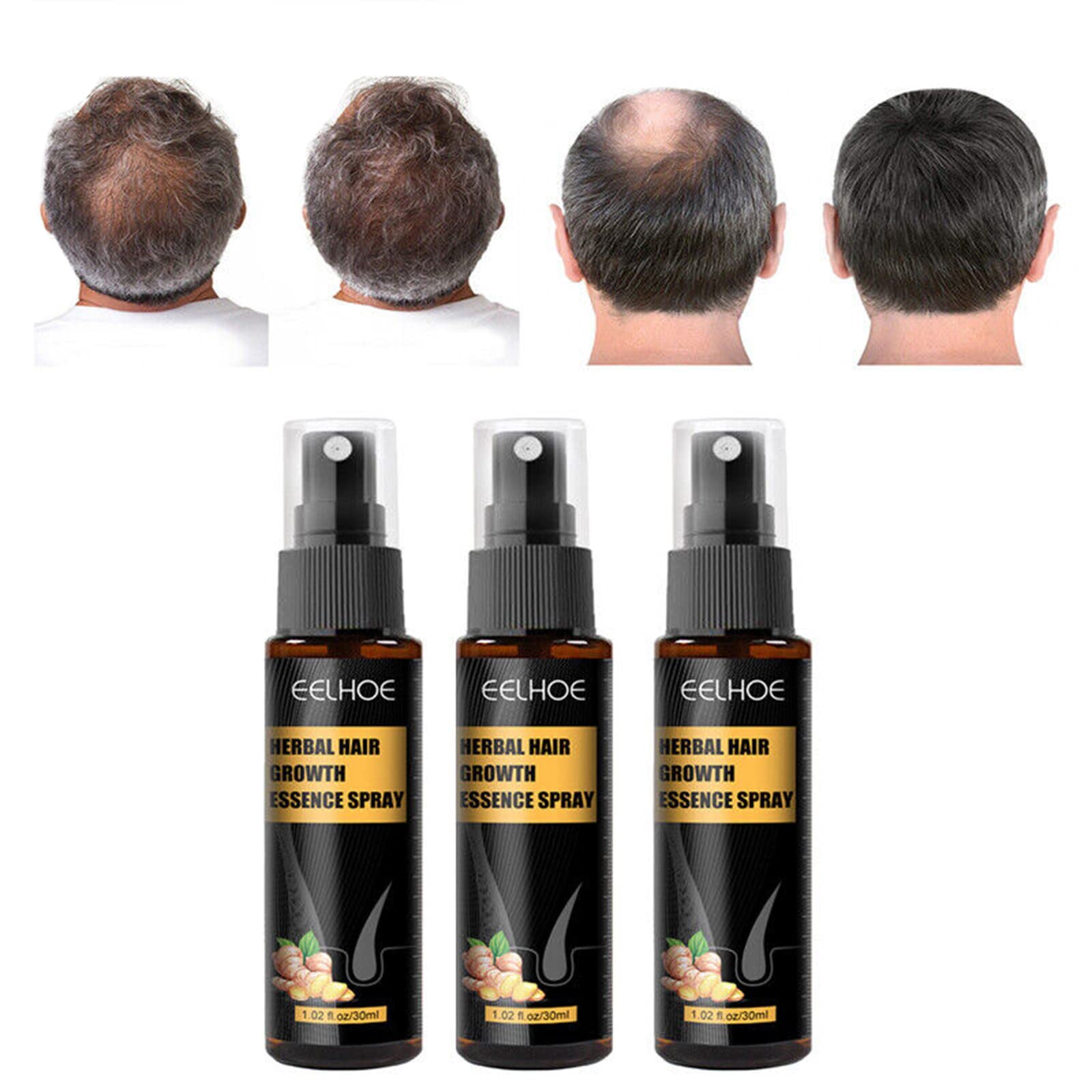 Buatkontly Hair Growth Spray Serum - Natural Ginger Hair Thickening Treatment for Fast Growth & Anti Hair Loss | Herbal Essence for Stronger, Thicker, Longer Hair | Perfect for Daily Scalp Care & Hair Regrowth