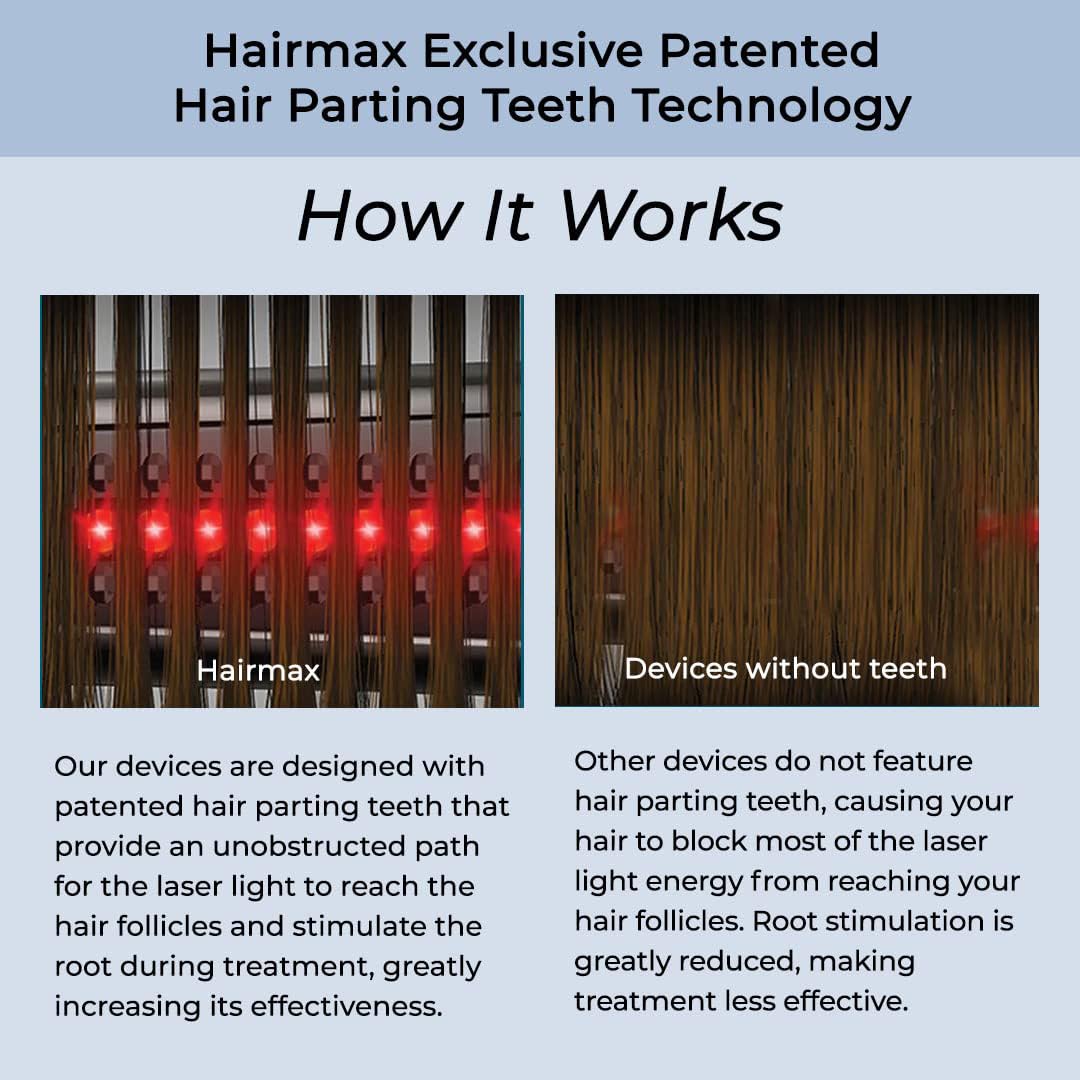 HairMax Ultima 9 Classic LaserComb - FDA Cleared Laser Hair Growth Device for Men & Women - Red Light Therapy Treatment for Thinning Hair & Hair Loss Prevention - Cordless Hair Regrowth Comb for Home Use - Perfect for Daily Hair Care Routine & Scalp Health Maintenance
