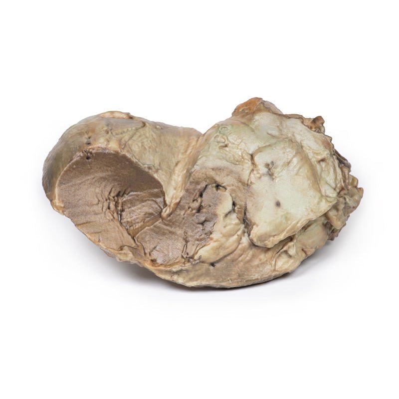 3D Printed Biscupid Aortic Valve - High Precision Medical Heart Valve Replacement for Cardiovascular Surgery - Ideal for Surgeons, Hospitals & Medical Training