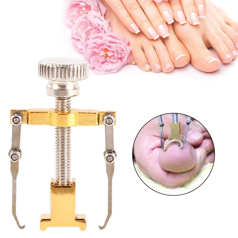Professional Ingrown Toenail Corrector Kit - Pain Relief & Treatment for Ingrown Nails, Paronychia - Pedicure Tools for Toe Care & Nail Correction - Perfect for Home Use & Salon Treatments