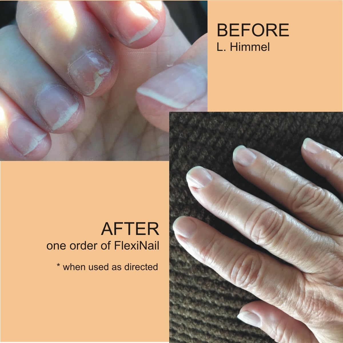 Premium Nail Strengthener & Cuticle Conditioner for Weak, Peeling, Brittle, and Cracking Nails - FlexiNail Formula for Stronger, Healthier Nails | Perfect for Manicures, Nail Care Routine & Daily Hydration