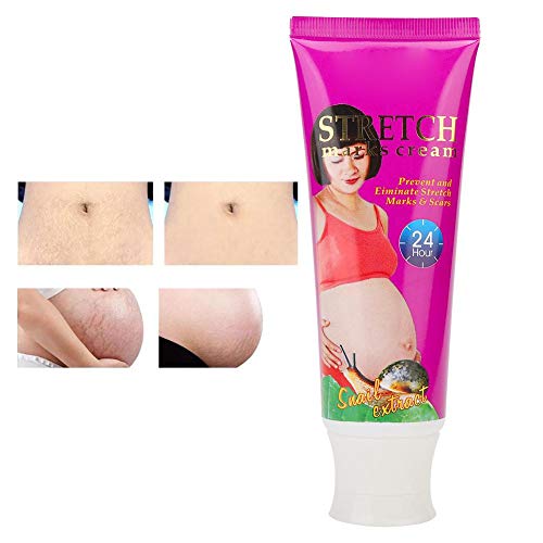 Brightening & Firming Skin Cream - Stretch Mark & Scar Removal Treatment for Smooth, Glowing Skin - Perfect for Daily Skincare & Post-Pregnancy Care
