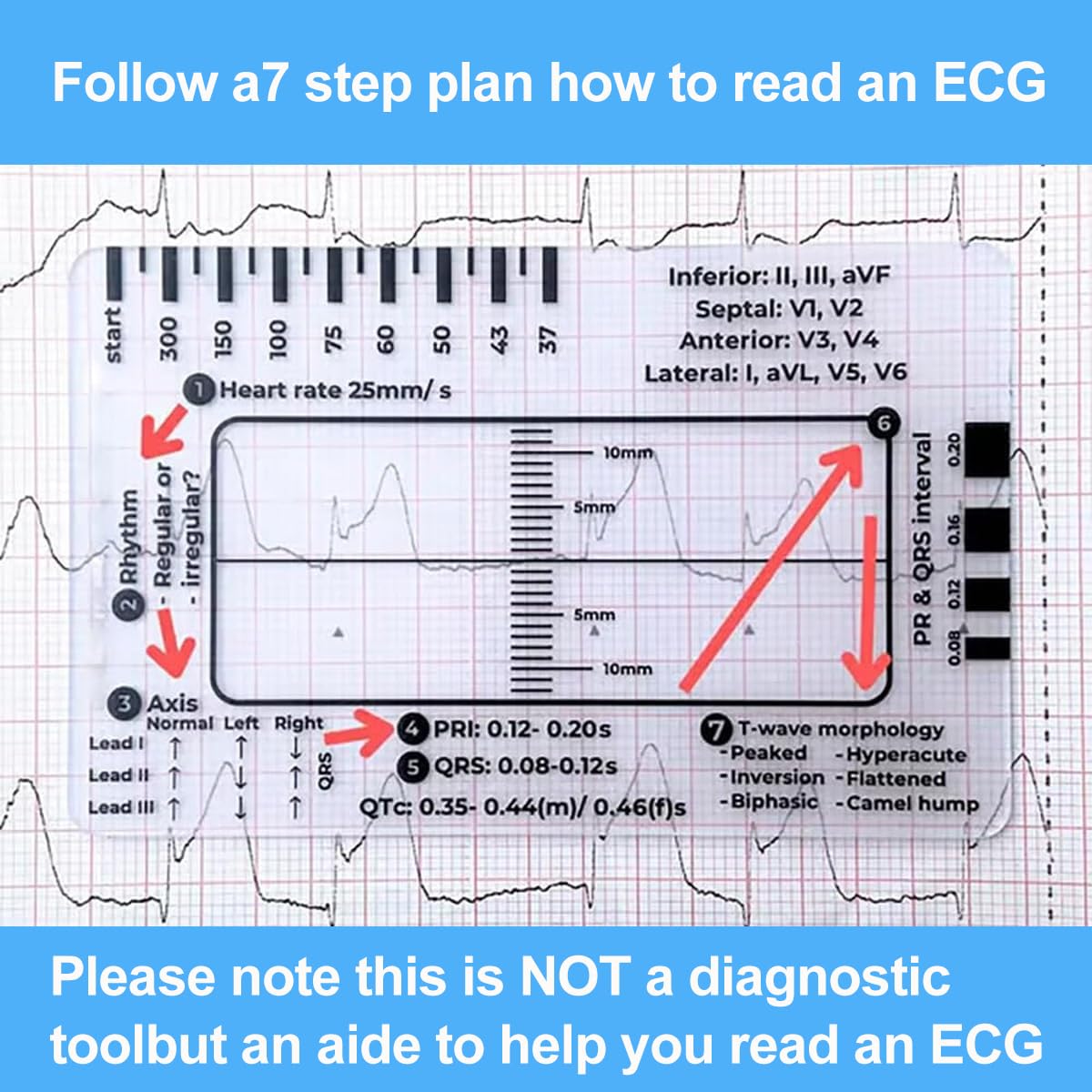 7-Step ECG Ruler for EKG Interpretation - Transparent Caliper Measuring Tool with Portable Assessment Card (2PCS) - Perfect for Medical Students, Nurses & Doctors for Heart Rate Monitoring & ECG Analysis