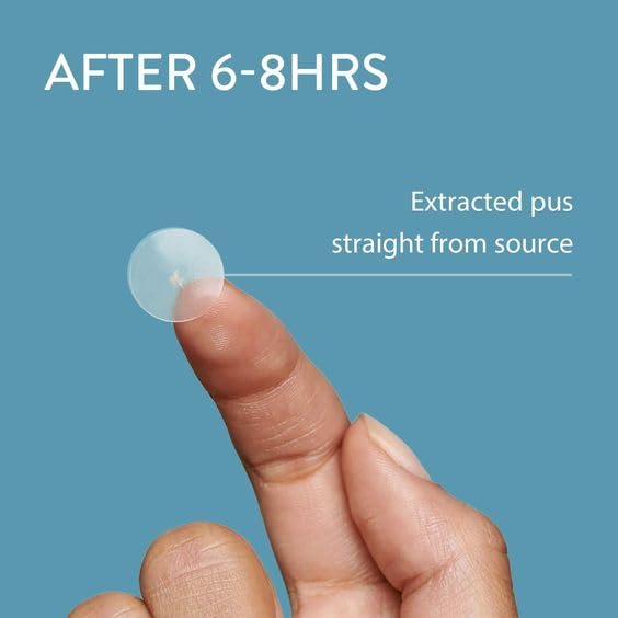 Hydrocolloid Acne Pimple Patch - 144 Dots | Fast Healing Spot Treatment for Zits, Blemishes & Breakouts | Vegan, Cruelty-Free Skincare | Perfect for Overnight Use & On-the-Go Spot Care