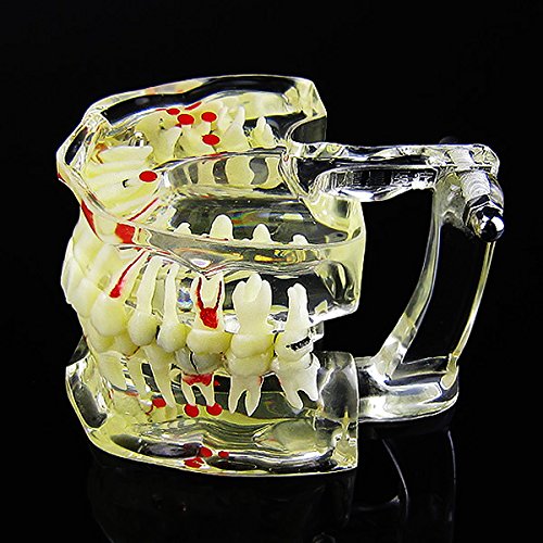Dental Study Model - Transparent Adult Teeth Pathological Model for Dentists & Students | Perfect for Dental Education, Training & Practice