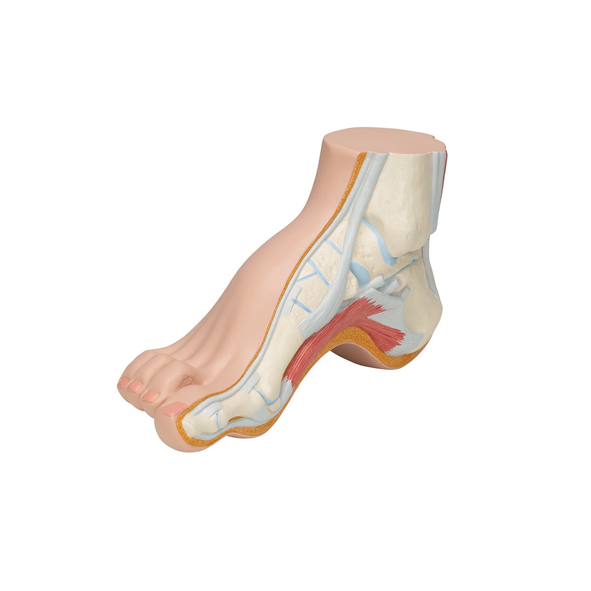 Best Orthotic Insoles for Hollow Foot (Pes Cavus) - High Arch Support for Pain Relief - Perfect for Running, Walking & Standing All Day