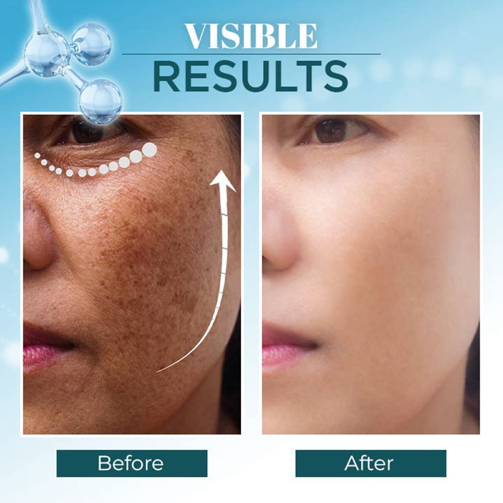Dark Spot Corrector for Face & Body - Natural Pigmentation Treatment with Cruelty-Free Ingredients | Brightening Serum for Women (30g) | Perfect for Daily Skincare Routine & Hyperpigmentation Care