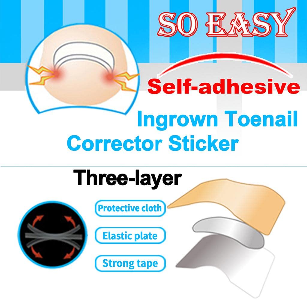 CALANDIS® Ingrown Toenail Corrector Stickers - 10PCS for Pain Relief & Paronychia Treatment - Toe Nail Care for Men & Women - Perfect for Runners, Athletes & Daily Foot Comfort