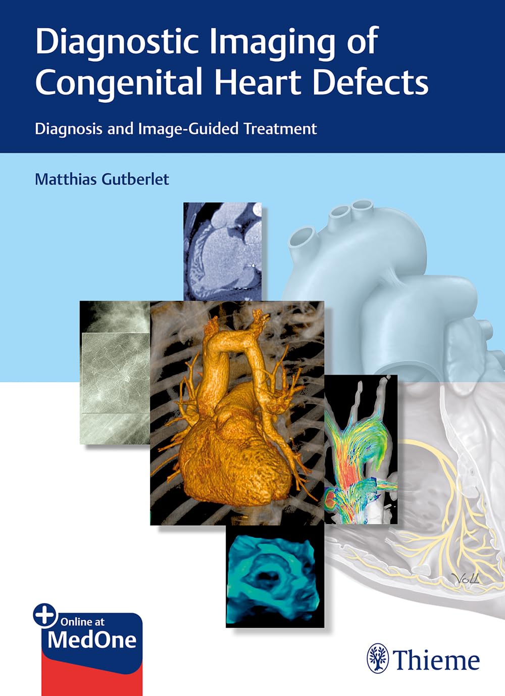 Diagnostic Imaging of Congenital Heart Defects: Diagnosis & Image-Guided Treatment for Pediatric Cardiology | Advanced Cardiac Imaging Techniques for Newborns & Children