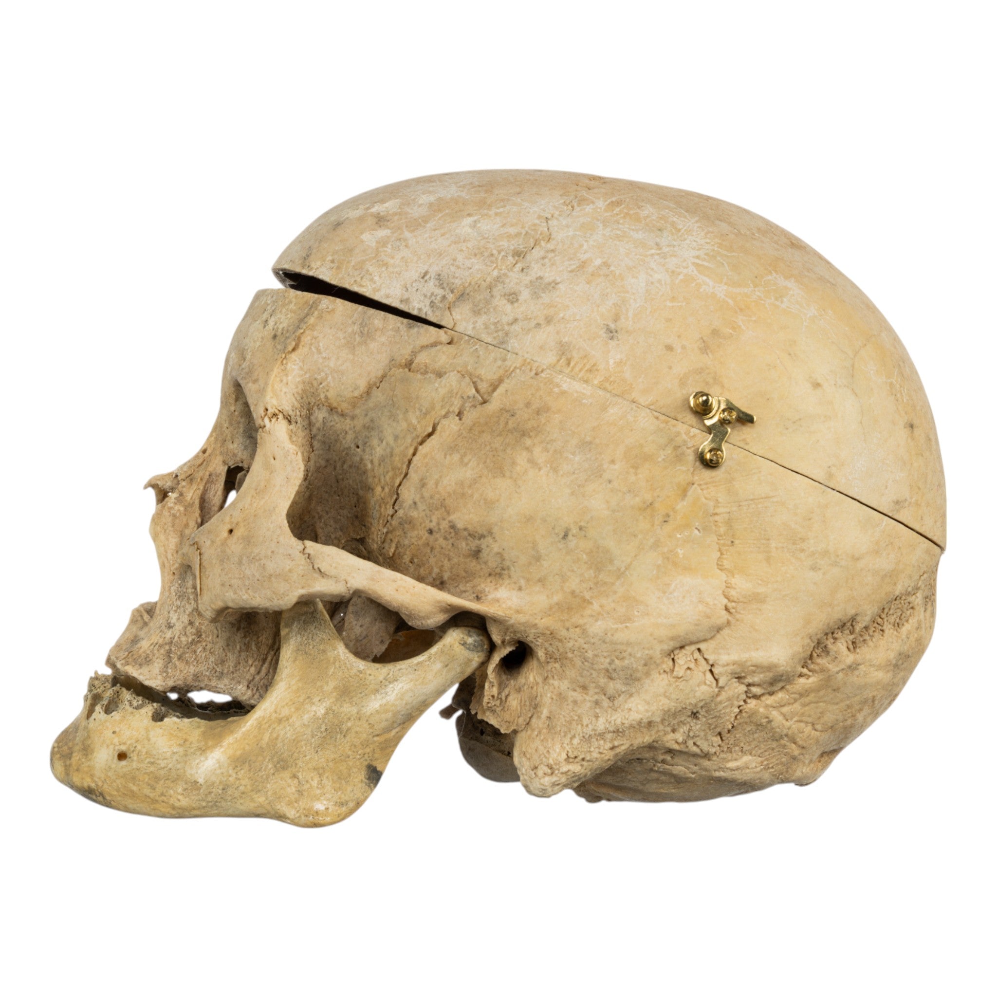 Authentic Human Skull for Medical Study, Halloween Decor, and Collectors - Perfect for Anatomy Education, Haunted House Props, and Oddity Collections