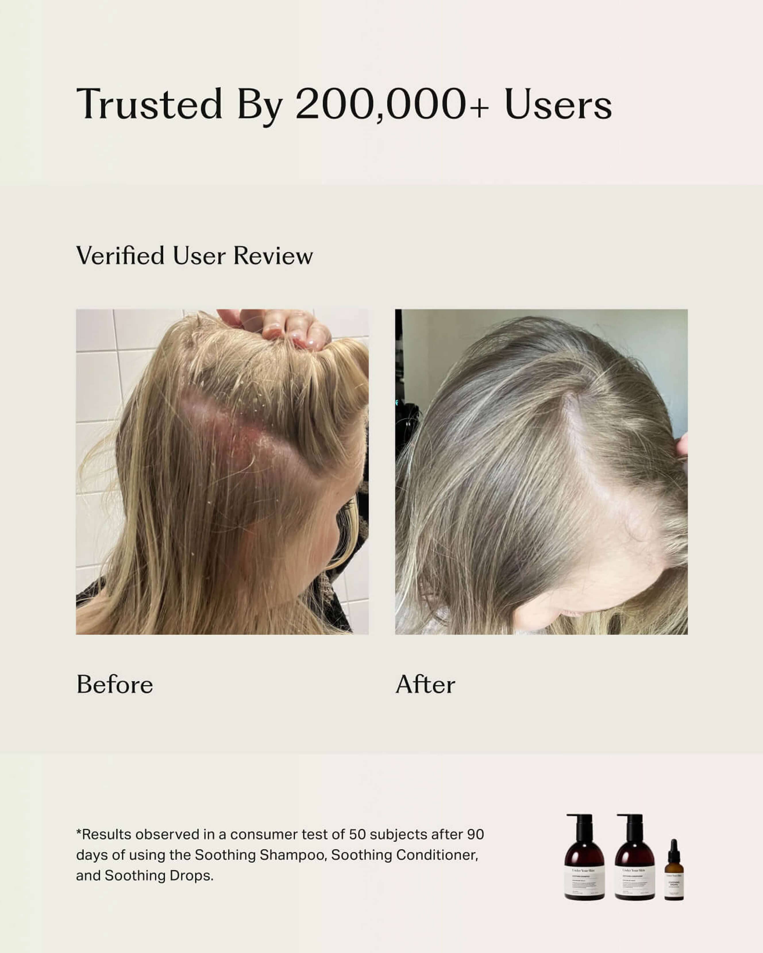 Soothing Scalp Treatment Shampoo for Dry Itchy Scalp - Hydrating & Anti-Dandruff Hair Care - Perfect for Sensitive Scalp & Daily Use