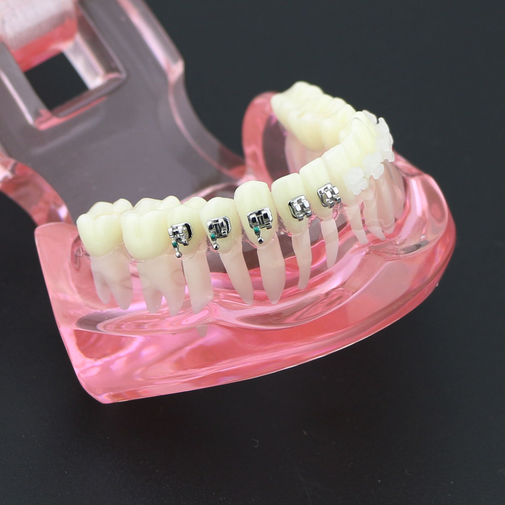 Dental Orthodontic Teeth Model with Metal & Ceramic Brackets - Professional Study Teeth Model for Dentists, Students & Orthodontic Training | Perfect for Dental Education, Practice & Office Display