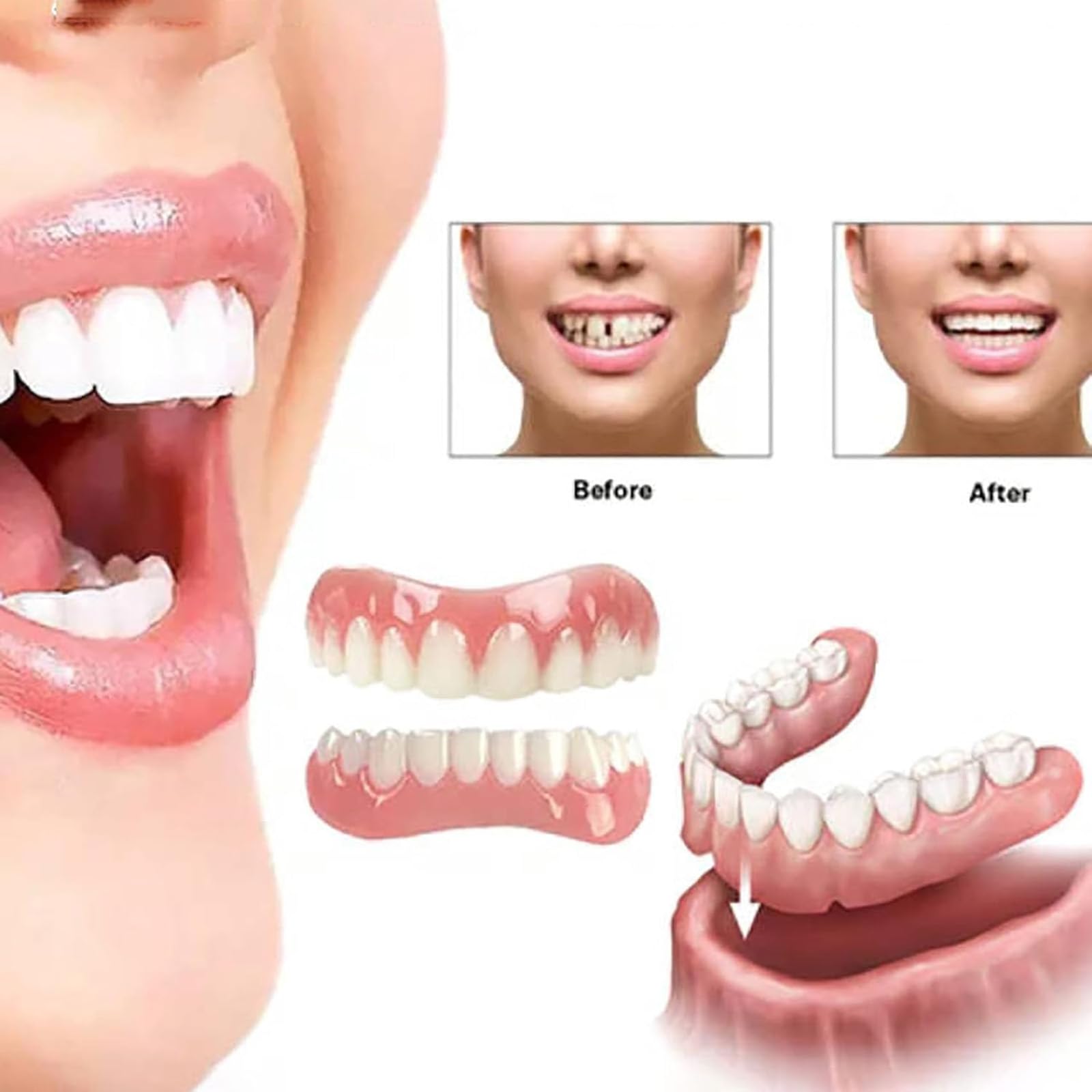 Premium Denture Reline Kit - Soft Silicone Denture Reliner for Comfortable Fit - Easy-to-Use Dental Relining Material for Men & Women - Perfect for Denture Adjustment & Pain Relief (1 Pack) - Ideal for Home Dental Care & Denture Maintenance