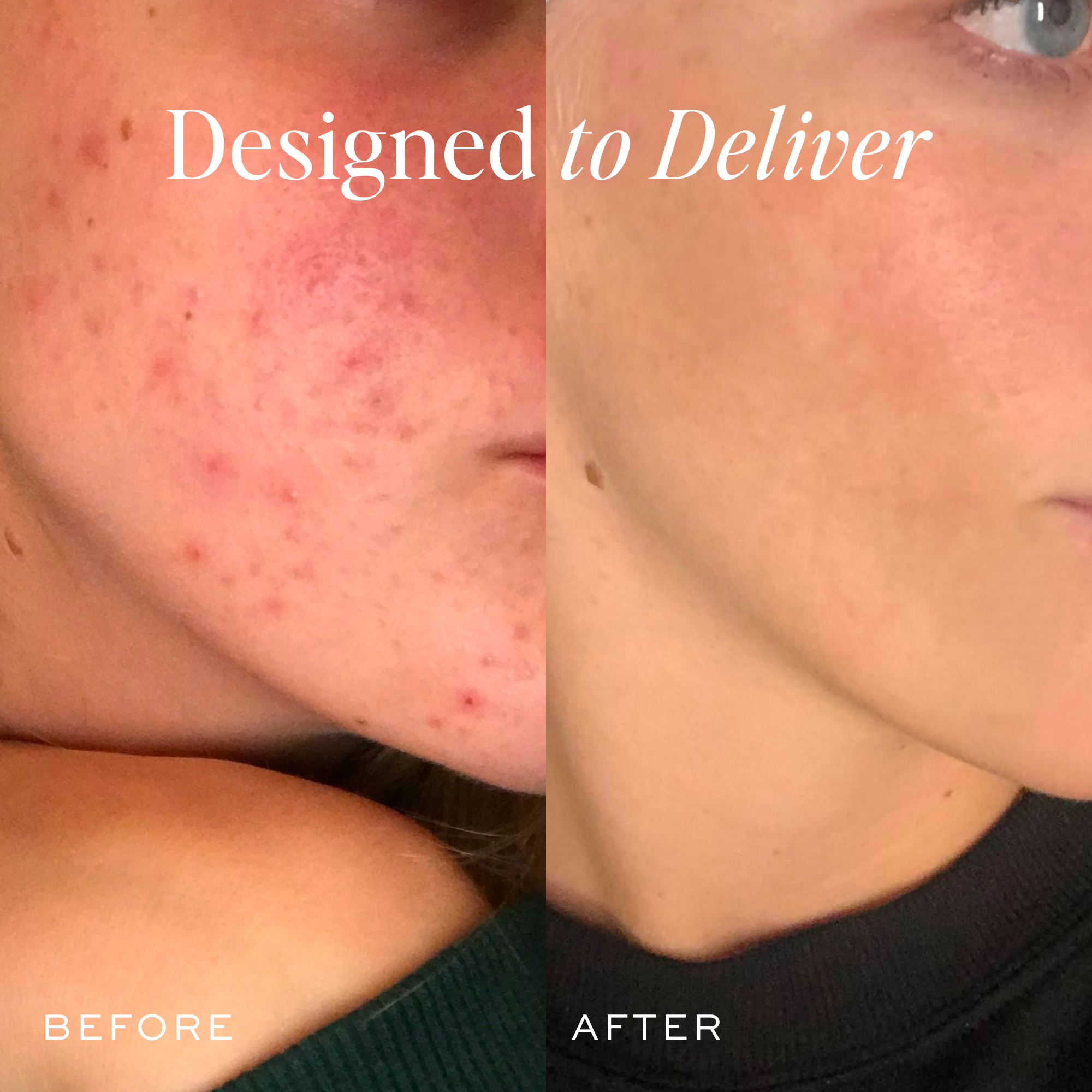 The Works Discovery Set - Premium Skincare Gift Set for Women | Hydrating, Anti-Aging & Brightening | Perfect for Travel, Gifting & Self-Care Routine