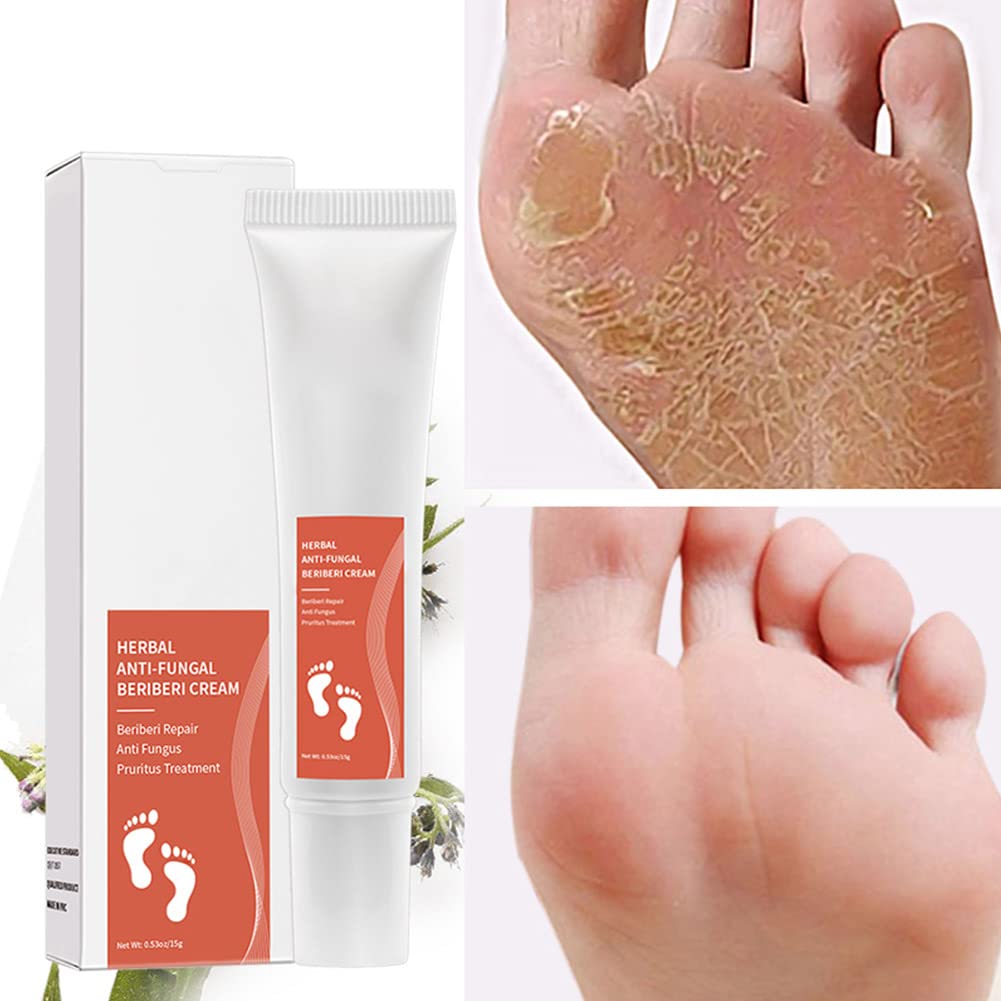 Allbesta Herbal Anti-Fungal Foot Cream - Treats Foot Infections, Reduces Inflammation & Relieves Itching - Effective for Athlete's Foot, Ringworm & Nail Fungus - Perfect for Daily Foot Care & Post-Workout Recovery