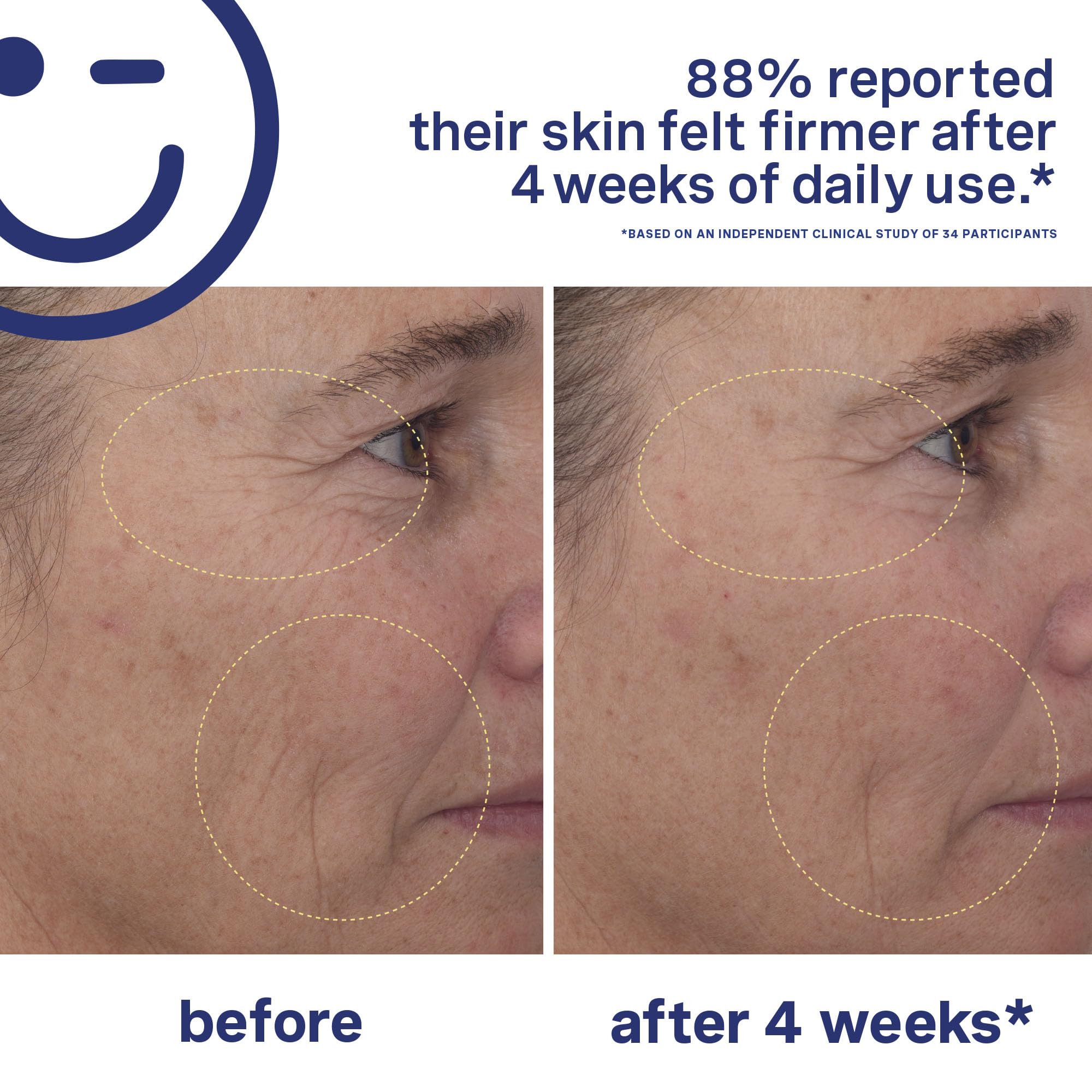 Kate Somerville Breakout Dream Team: EradiKate 3% Sulfur Daily Foaming Cleanser for Acne Treatment (4 oz) & Mega-A Skin Transforming Anti-Aging Serum with Retinal (1 oz) - Perfect for Daily Skincare Routine and Fighting Acne + Wrinkles