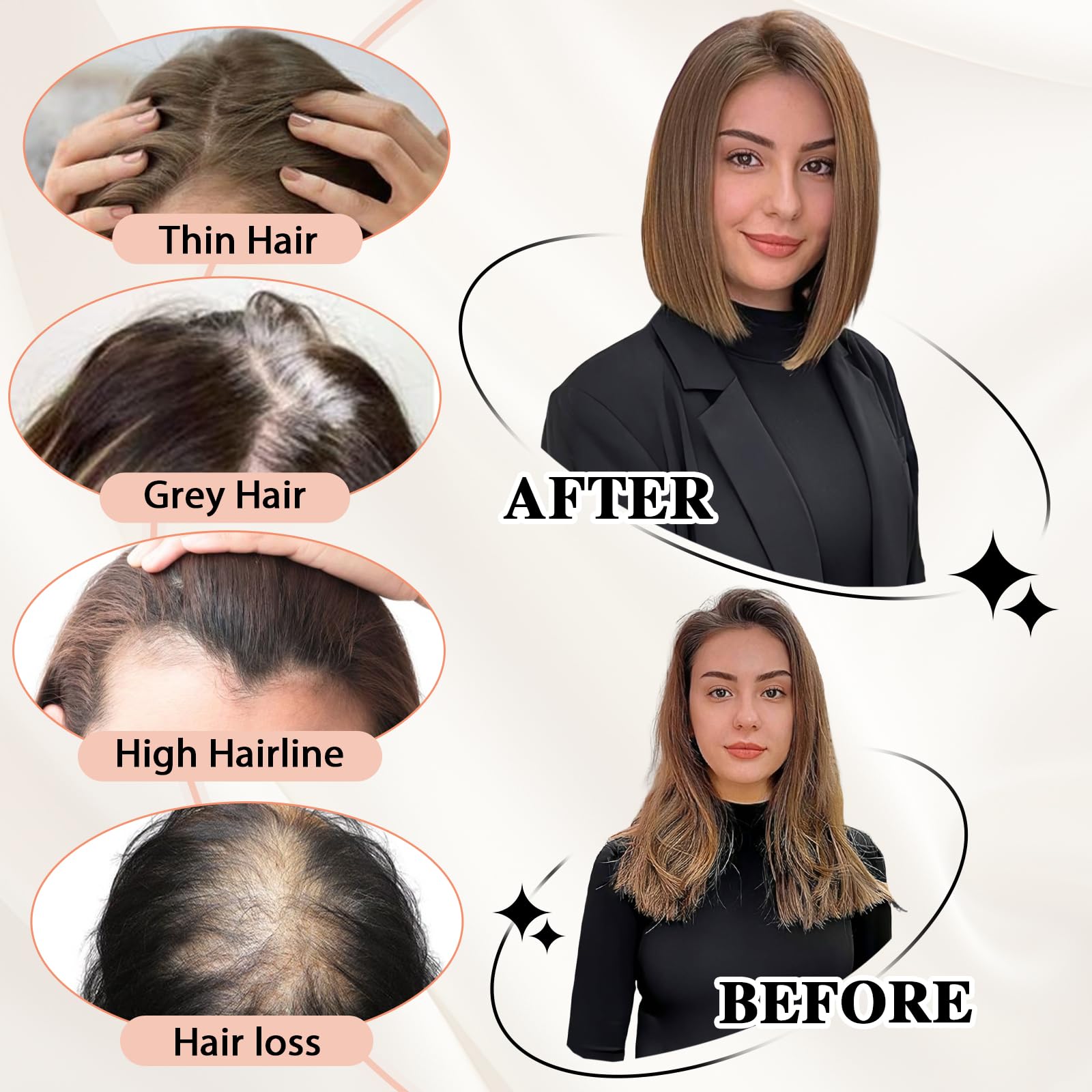 Starluck Women's Real Human Hair Toppers - 5