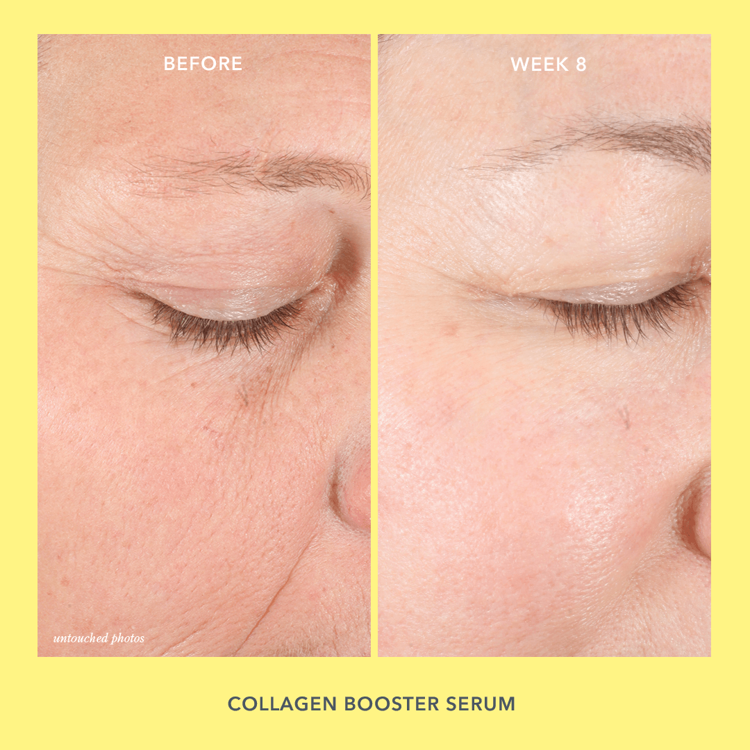 Tighten Up Skincare Set - Anti-Aging Face Cream & Serum for Firmer Skin | Perfect for Night Routine & Wrinkle Reduction