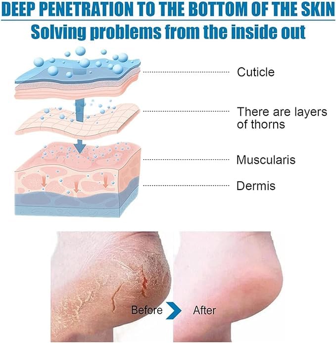 ADBHUTANAND Natural Foot Peeling Mask - Exfoliating Treatment for Dry Skin, Callus & Cracked Heels | Dead Skin Removal | Baby Soft Smooth Feet | 1 Count | Perfect for Pedicures & At-Home Foot Care