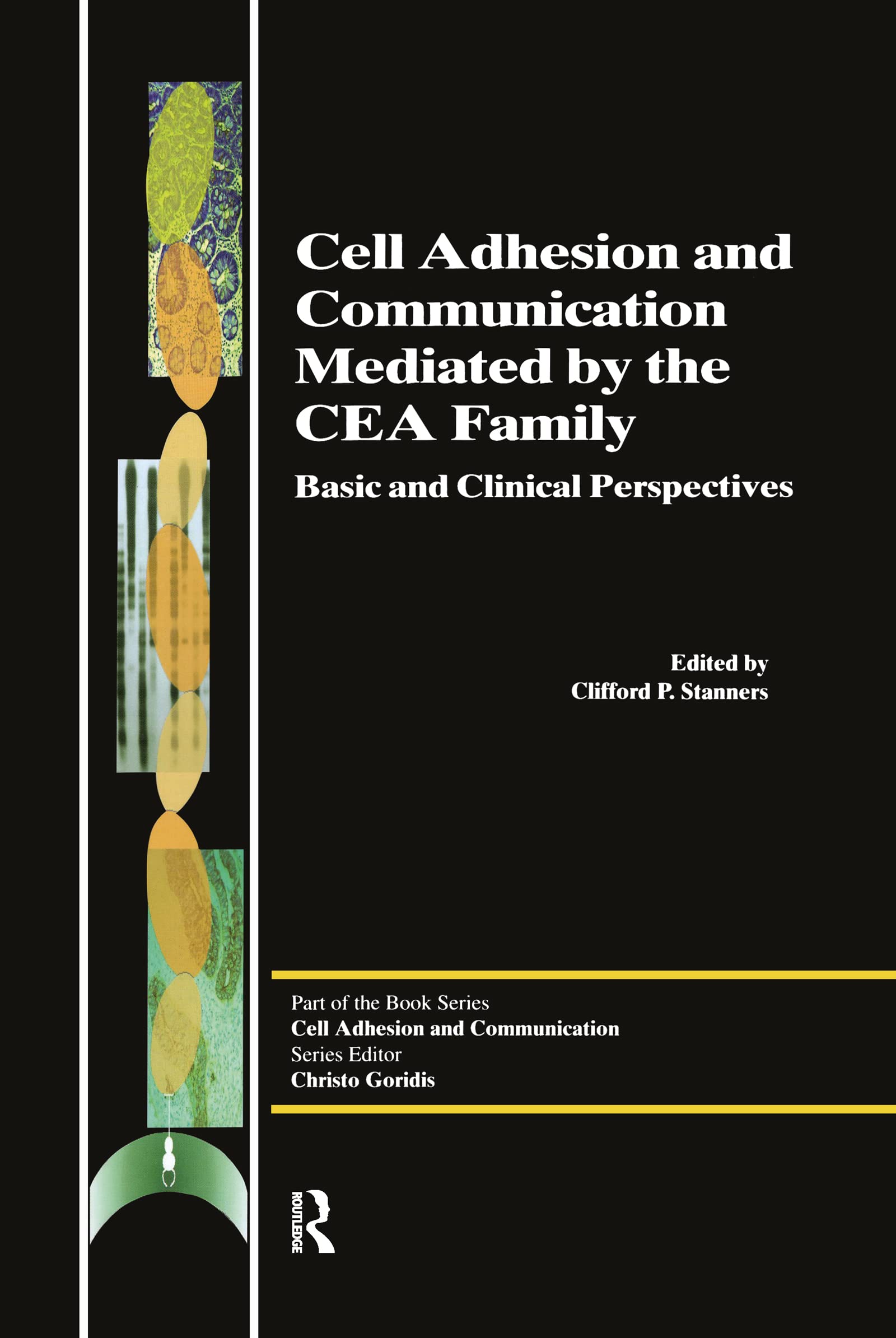 CEA Family Proteins: Key Mediators of Cell Adhesion and Cellular Communication | Essential for Cancer Research & Immune System Studies
