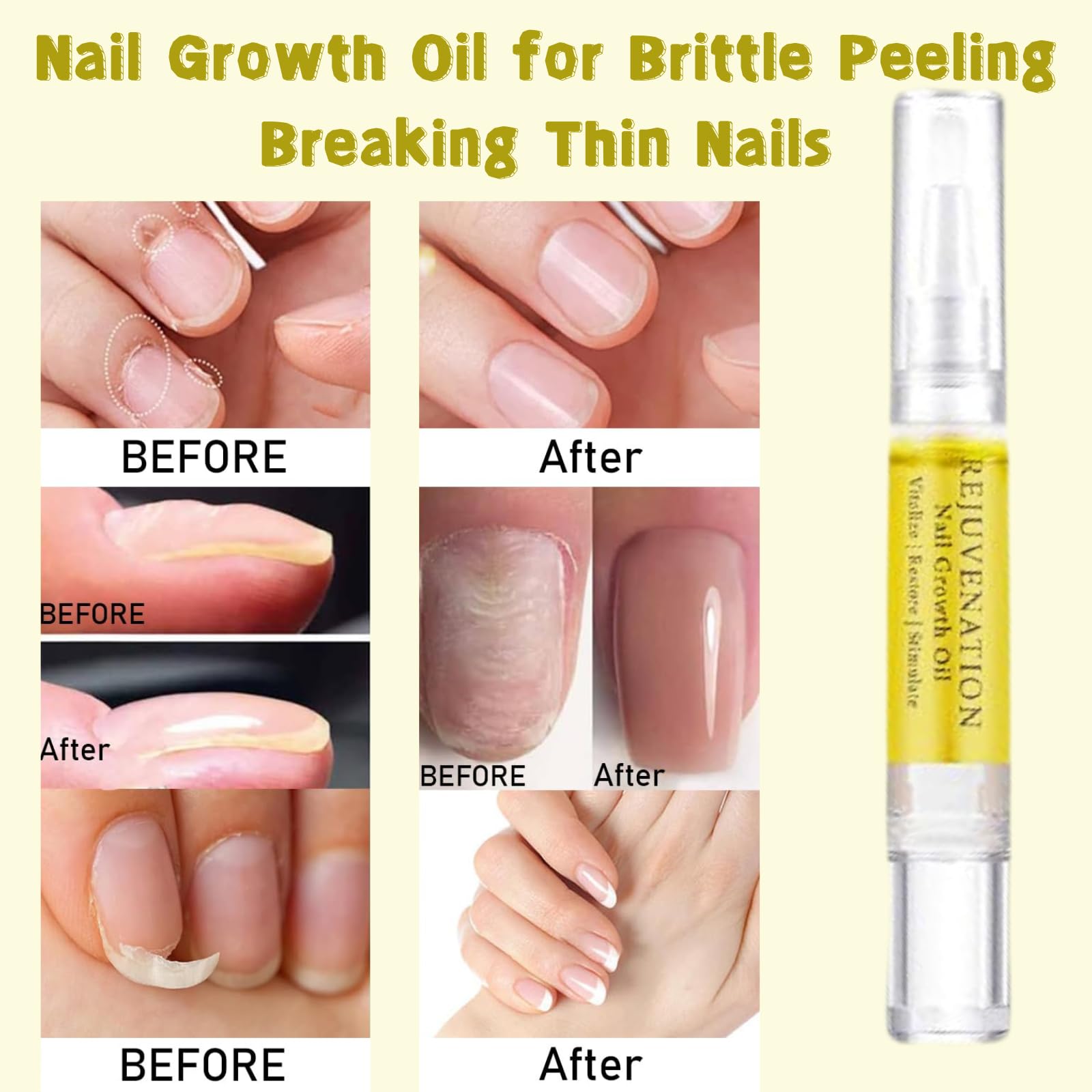 4Pcs Nail Growth Oil Pen for Brittle, Peeling & Weak Nails - Cuticle Oil Strengthener & Nail Care Treatment - Perfect for Manicures, Nail Salons & At-Home Nail Care