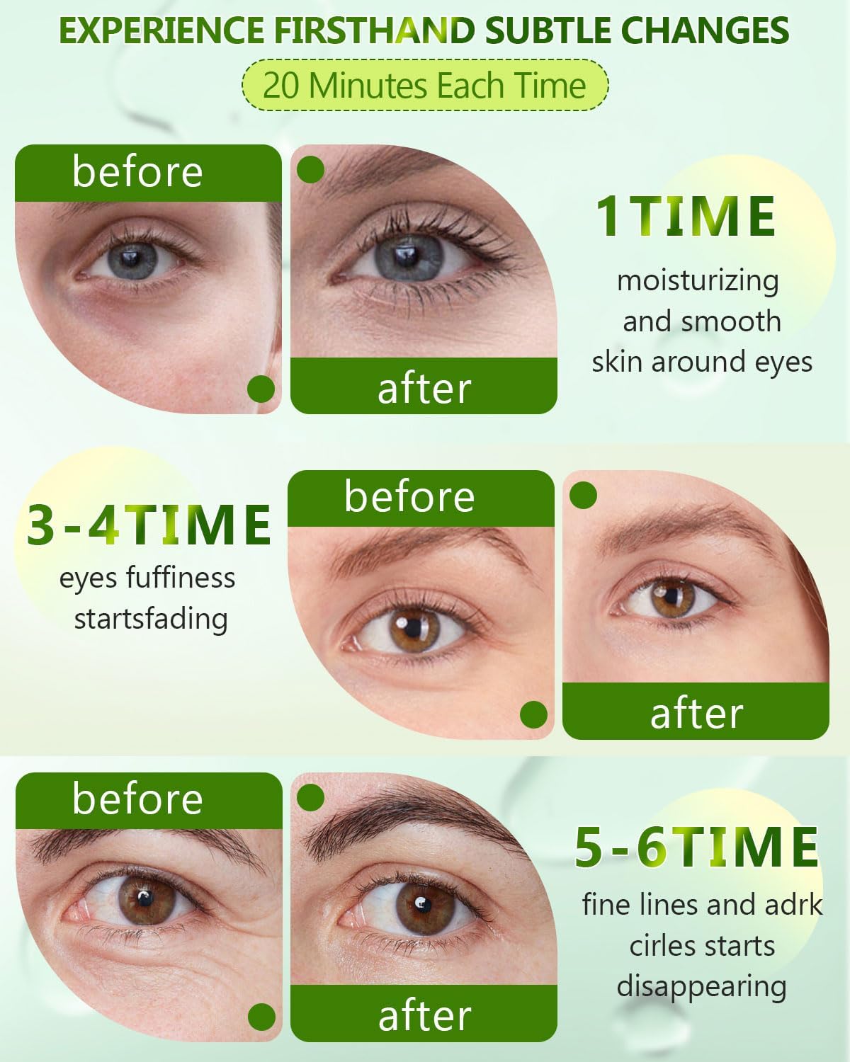 120 Pcs Chlorella Eye Patches with Collagen - Reduce Puffy Eyes & Dark Circles, Combat Fine Lines & Wrinkles, Gentle Under Eye Masks for Dark Circle Treatment - Perfect for Night Routine, Travel & Skincare Regimen
