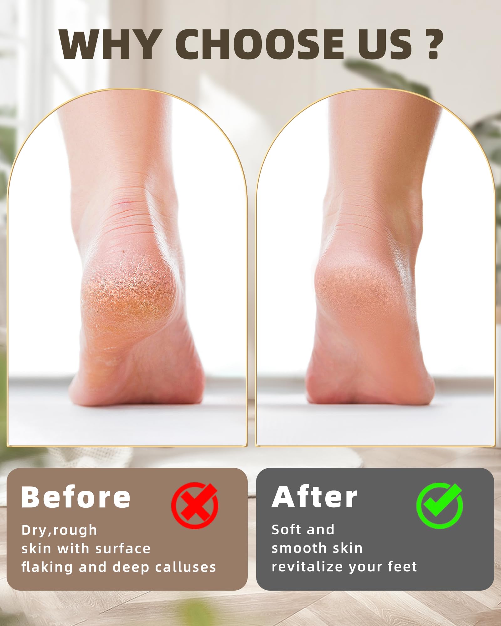 Professional Electric Callus Remover Kit - Rechargeable Foot Sander with 3 Stainless Steel Rollers & 3-Speed Settings - Portable Electric Foot Filer for Smooth Heels & Dead Skin Removal - Perfect for Pedicures, Home Foot Care & Salon Use