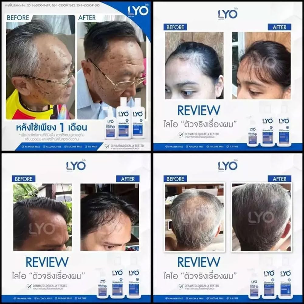 Lyo Shampoo Conditioner Set with Hair Tonic Treatment - Strengthens Hair & Promotes Regrowth for Thicker, Healthier Locks - Perfect for Daily Hair Care Routine & Scalp Nourishment
