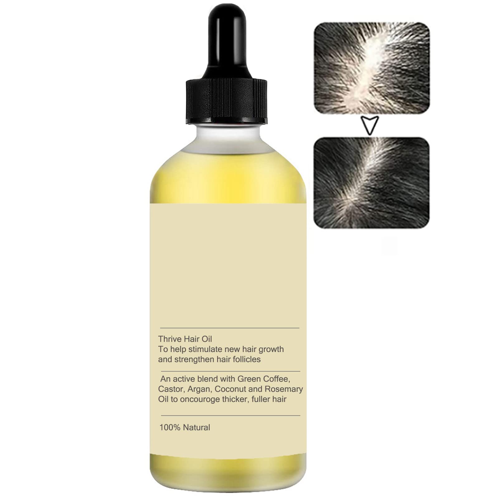 Natural Hair Growth Oil & Serum with Caffeine, Biotin & Essential Oils (Rosemary, Castor, Argan, Coconut) - Stimulates Hair Growth, Nourishes Scalp & Treats Dry Hair - Perfect for Thinning Hair, Hair Loss & Daily Scalp Care