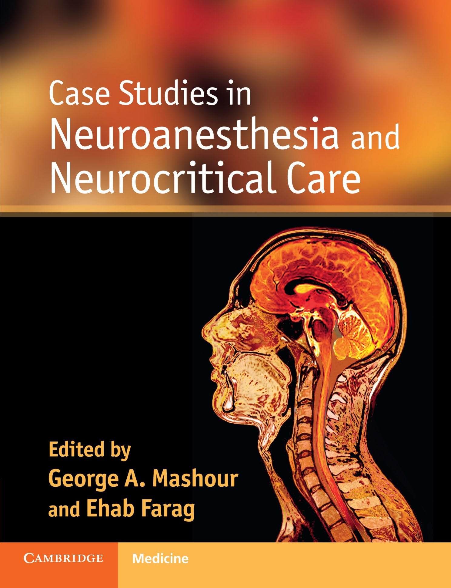 Neuroanesthesia and Neurocritical Care Case Studies - Clinical Neurology Book for Medical Professionals | Ideal for Anesthesiologists, ICU Doctors & Neurology Residents