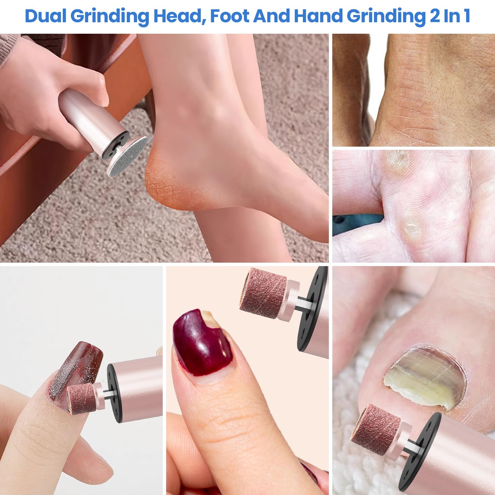 Professional Electric Callus Remover & Foot File - Rechargeable 2-in-1 Pedicure Tool for Dry Dead Skin Removal, 6 Adjustable Speeds with Sandpaper Disks - Perfect for Home Pedicures & Foot Care Routine