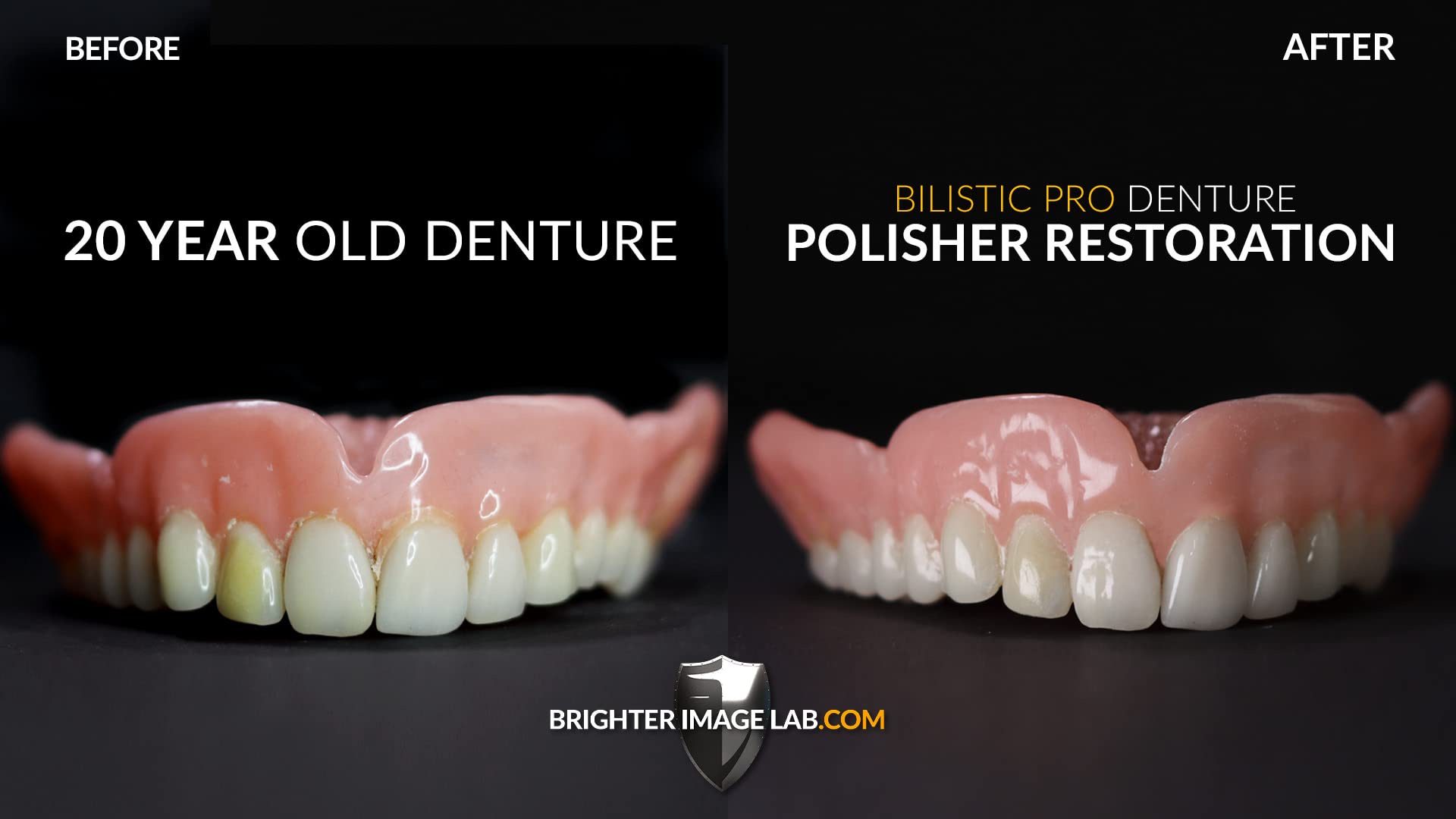 Bilistic Pro Series Denture Cleaner & Polisher - Professional Strength Denture Cleaning Tablets for Fresh Breath & Stain Removal - Perfect for Daily Denture Care at Home or Travel